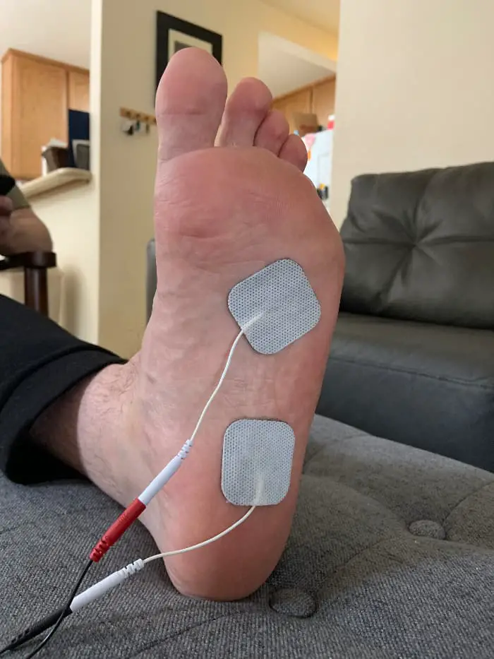 the-correct-tens-unit-placement-for-plantar-fasciitis-optimize-health-365