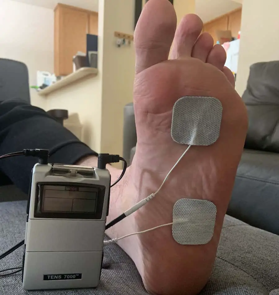 This is The Correct TENS Unit Placement for Plantar Fasciitis