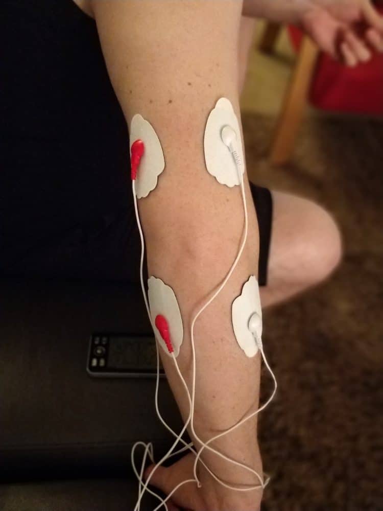 Stop Golfer’s Elbow Pain with this TENS Unit Placement Optimize