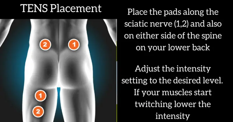 TENS unit placement for sciatica nerve pain - Optimize ...