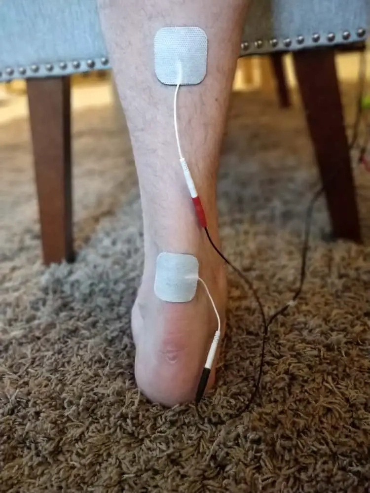 Use This Tens Unit Placement For Achilles Tendonitis Optimize Health 365