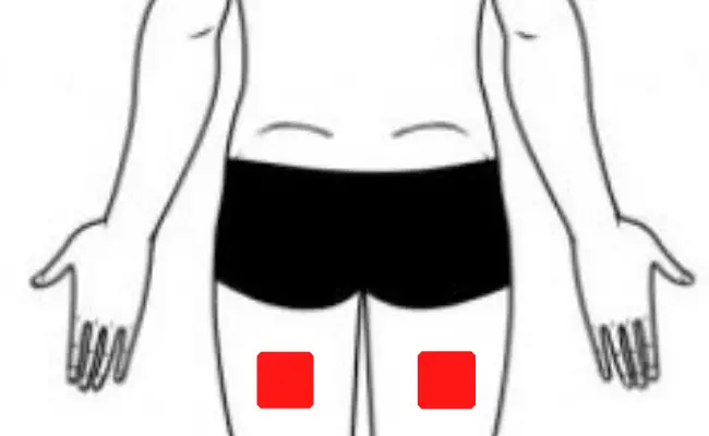 TENS placement for Restless leg syndrome TENS placement for Restless leg syndrome